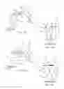 Fig. 09 - Vehicles with fender structure assemblies and deforming fender attachment brackets