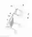 Fig. 01 - Trolley with a player
