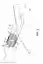 Fig. 02 - Receptacle, payload assembly and related methods for an aircraft