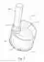 Fig. 04 - Package with Luer fitting storage insert