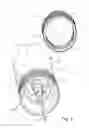 Fig. 06 - Package with Luer fitting storage insert
