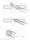 Fig. 03 - Frame support