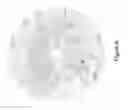 Fig. 07 - Piperazine derivatives for treating disorders