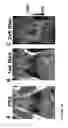 Fig. 11 - Molecular Imaging Probes
