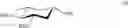 Fig. 40 - Reagent-controlled stereoselective glycosylation