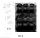 Fig. 03 - Ship inhibitors and uses thereof
