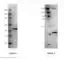 Fig. 02 - Vaccine