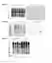 Fig. 04 - Variants of C-Type Natriuretic Peptide
