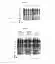 Fig. 09 - Variants of C-Type Natriuretic Peptide