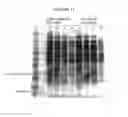 Fig. 13 - Variants of C-Type Natriuretic Peptide