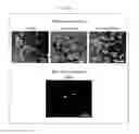 Fig. 16 - Composition for inducing differentiation