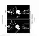 Fig. 24 - Antigen binding constructs to target molecules