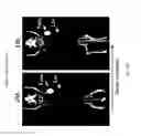 Fig. 28 - Antigen binding constructs to target molecules