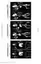 Fig. 34 - Antigen binding constructs to target molecules