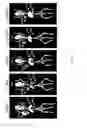 Fig. 70 - Antigen binding constructs to target molecules