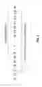 Fig. 05 - Method of inhibiting human IL-1 beta by administering an antibody to human IL-1 beta