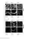 Fig. 24 - MODIFIED PSEUDOMONAS EXOTOXIN A