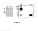 Fig. 03 - METHOD OF DETECTING OCULAR DISEASES AND PATHOLOGIC CONDITIONS AND TREATMENT OF SAME