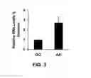 Fig. 04 - METHOD OF DETECTING OCULAR DISEASES AND PATHOLOGIC CONDITIONS AND TREATMENT OF SAME