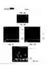 Fig. 06 - METHOD OF DETECTING OCULAR DISEASES AND PATHOLOGIC CONDITIONS AND TREATMENT OF SAME