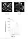 Fig. 08 - METHOD OF DETECTING OCULAR DISEASES AND PATHOLOGIC CONDITIONS AND TREATMENT OF SAME