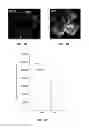 Fig. 09 - METHOD OF DETECTING OCULAR DISEASES AND PATHOLOGIC CONDITIONS AND TREATMENT OF SAME