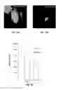 Fig. 10 - METHOD OF DETECTING OCULAR DISEASES AND PATHOLOGIC CONDITIONS AND TREATMENT OF SAME
