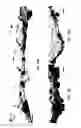 Fig. 14 - METHOD OF DETECTING OCULAR DISEASES AND PATHOLOGIC CONDITIONS AND TREATMENT OF SAME