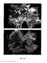 Fig. 16 - METHOD OF DETECTING OCULAR DISEASES AND PATHOLOGIC CONDITIONS AND TREATMENT OF SAME