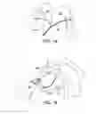Fig. 08 - Low cytotoxicity switchable adhesive compositions, medical dressings and skin coverings, and methods of treatment using same