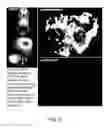 Fig. 07 - Vesicular stomatitis viruses