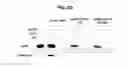 Fig. 16 - Hexon isolated from simian adenovirus serotype 19, hypervariable region thereof and chimeric adenovirus using the same