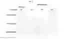 Fig. 23 - Hexon isolated from simian adenovirus serotype 19, hypervariable region thereof and chimeric adenovirus using the same