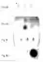 Fig. 06 - Chimeric protein toxins for expression by therapeutic bacteria