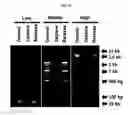 Fig. 14 - NANOSTRUCTURE FOR DETECTING CELL-FREE DNA USING CONDUCTIVE POLYMER AND THE USE THEREOF