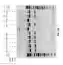 Fig. 28 - Compositions and methods of nucleic acid-targeting nucleic acids