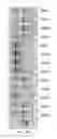 Fig. 55 - Compositions and methods of nucleic acid-targeting nucleic acids