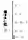 Fig. 07 - Methods for treating progeroid laminopathies using oligonucleotide analogues targeting human LMNA