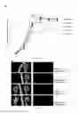 Fig. 07 - VASCULAR RE-MODELLING