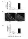 Fig. 12 - Methods and compositions for inhibiting retinopathy of prematurity