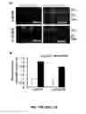 Fig. 14 - Methods and compositions for inhibiting retinopathy of prematurity