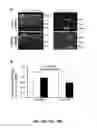 Fig. 15 - Methods and compositions for inhibiting retinopathy of prematurity