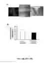 Fig. 19 - Methods and compositions for inhibiting retinopathy of prematurity