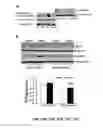 Fig. 21 - Methods and compositions for inhibiting retinopathy of prematurity