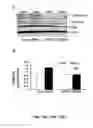 Fig. 24 - Methods and compositions for inhibiting retinopathy of prematurity