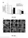 Fig. 33 - Methods and compositions for inhibiting retinopathy of prematurity