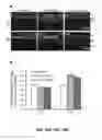 Fig. 35 - Methods and compositions for inhibiting retinopathy of prematurity