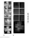Fig. 40 - Methods and compositions for inhibiting retinopathy of prematurity