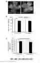 Fig. 42 - Methods and compositions for inhibiting retinopathy of prematurity
