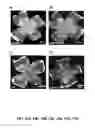 Fig. 43 - Methods and compositions for inhibiting retinopathy of prematurity